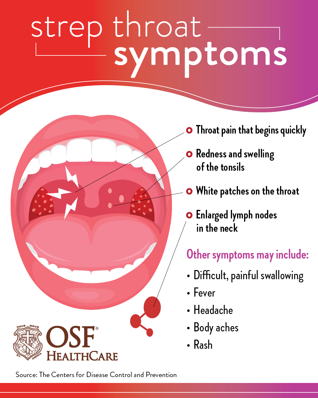 Featured image of post Sore Throat Images Symptoms