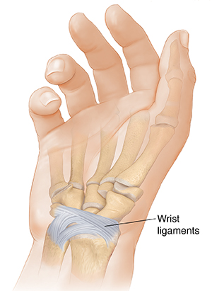 wallpapers Torn Ligament In Wrist Pictures