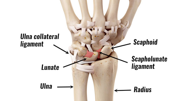 photo Torn Ligament In Wrist Pictures